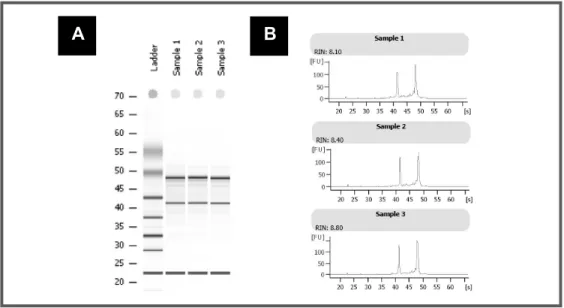 FIGURE 2.5:  Gel image and electropherogram output from Agilent 2100 Bioanalyser – Assessment of RNA integrity