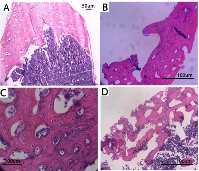Figure 1:   Haematoxylin and Eosin  staining of bone samples  taken during  isolation of cells  from the long bones of rats