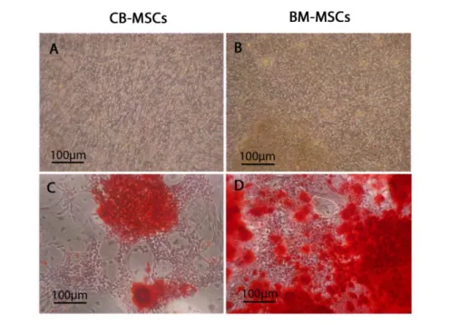 Figure 5: Osteogenic differentiation of CB-MSCs and BM-MSCs at PD50.  Cells were cultured  for 28 days in the absence (A and B) or presence (C and D) of osteoinductive media and mineral  deposition visualised by Alizarin Red staining