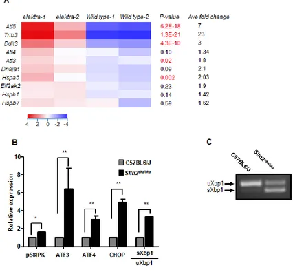 Figure 1: High expression of er stress related genes in elektraarray shows differentially expressed genes in C57BL6/J and Slfn2significant are marked by red font) inflammatory monocytes