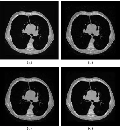 Figure 2.5: Reconstruction of a 256 × 256 Lung image from 64 Radon measurements with noise variance corresponding to the input SNR of 50 dB: (a) original; (b) linear (SNR = 18.86 dB); (c) wavelet-domain ℓ 1 (SNR = 19.8 dB); (d) TV (SNR = 21.89 dB).