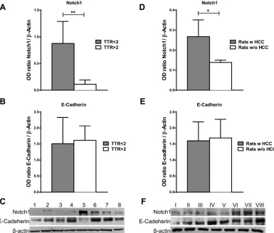 Figure 5: Notch1 and E-Cadherin expression in non-tumor liver tissue. (A–b) Notch1 and E-Cadherin expression were evaluated by western blot in cirrhotic tissues surrounding HCC and a higher Notch1 expression was observed in cases with poor (< 2 years) vs