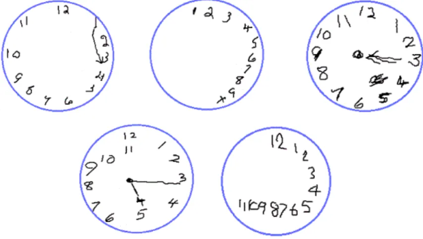 Fig. 2. Examples of clock drawings produced by people diagnosed with dementia. 