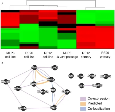 Figure 7: Multiomics analysis of combined transcriptome and proteome data. A. heatmap showing relatedness between the samples, on the basis of these 17 transcripts/proteins it is possible to distinguish primary AMLs from cell lines