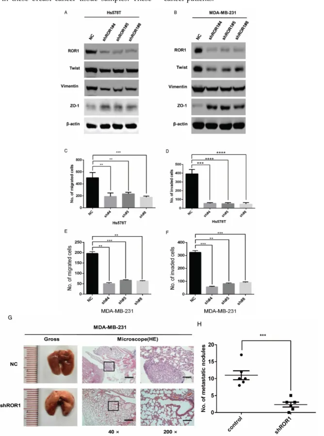 Figure 3. ROR1 positively regulates migration, invasion and cancer metastasis in BLBC