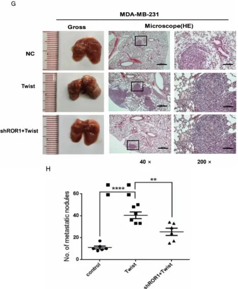 Figure 4. The promotion of cell migration, invasion and cancer metastasis after Twist overexpression primarily depends on ROR1