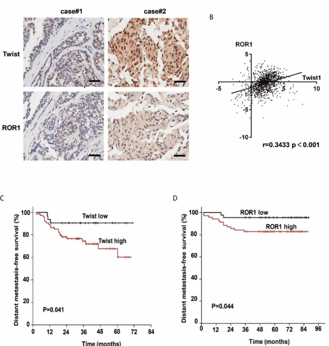 Figure 5. The expression of Twist and ROR1 correlates with clinical prognosis in breast cancer