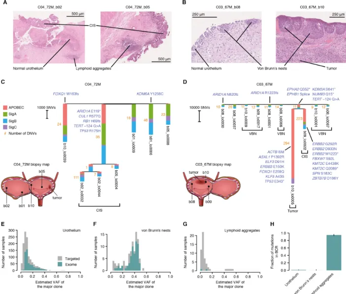 Fig. 4. The mutational landscape across histological features in patients with bladder cancer