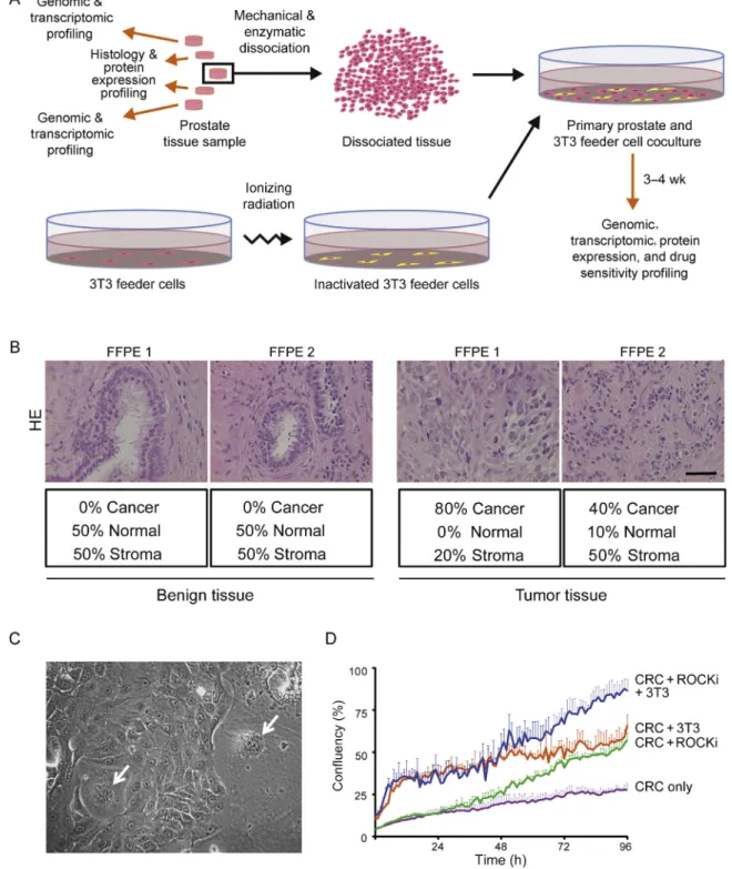 Fig. 1 – Diagram of tissue processing and establishment of conditionally reprogrammed cells (CRCs)