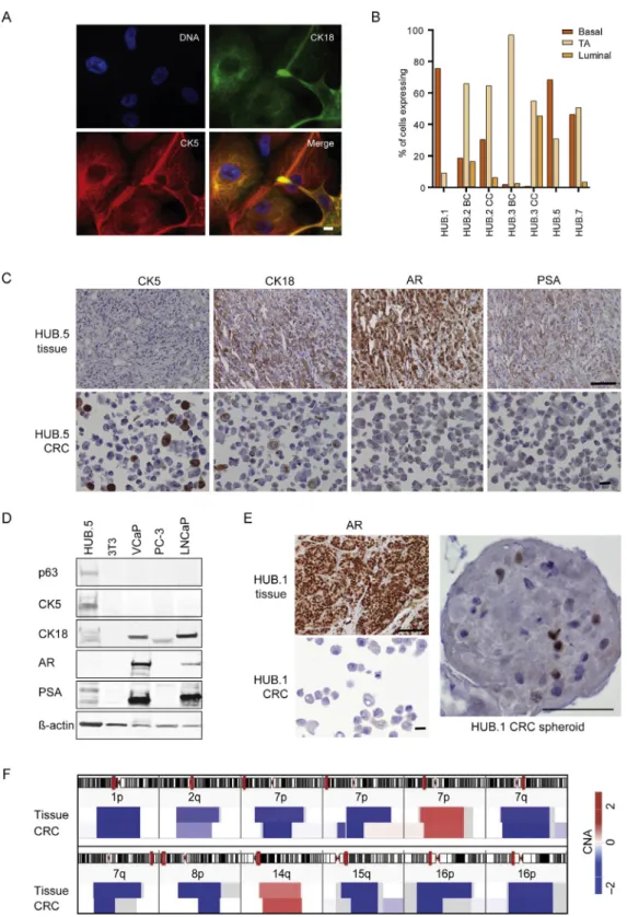 Fig. 2 – Characterization of conditionally reprogrammed cells (CRCs) and the parental tissue