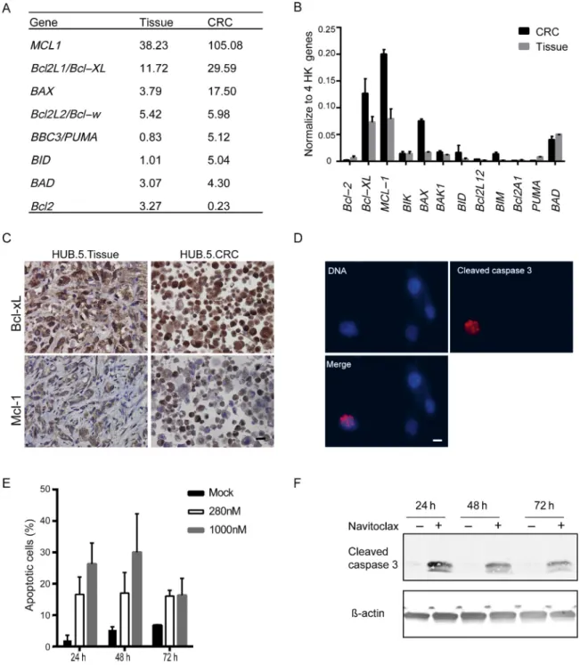 Fig. 4 – The expression of Bcl-2 family members and impact of navitoclax in castration-resistant prostate cancer derived conditionally reprogrammed cells (CRCs)