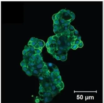 Fig. 2.8 Fluorescent microscopy image of a hyaluronic acid hydrogel 3D tumor culture. In this study, cells  were stained with phalloidin for F-actin, which shows the structure and function of the cells