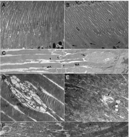 Fig. 8. Transmission electron microscopy analysis of inner and outer segment region at 12 months of age