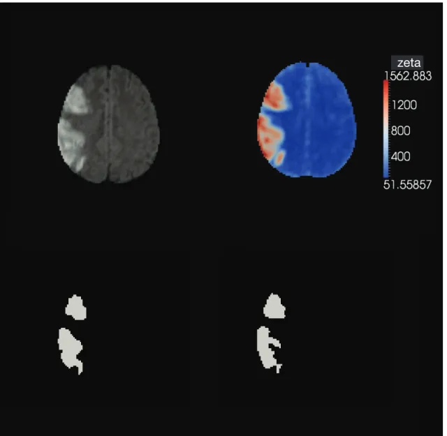 Figure 2.8 - Zeta segmentation (cortical).