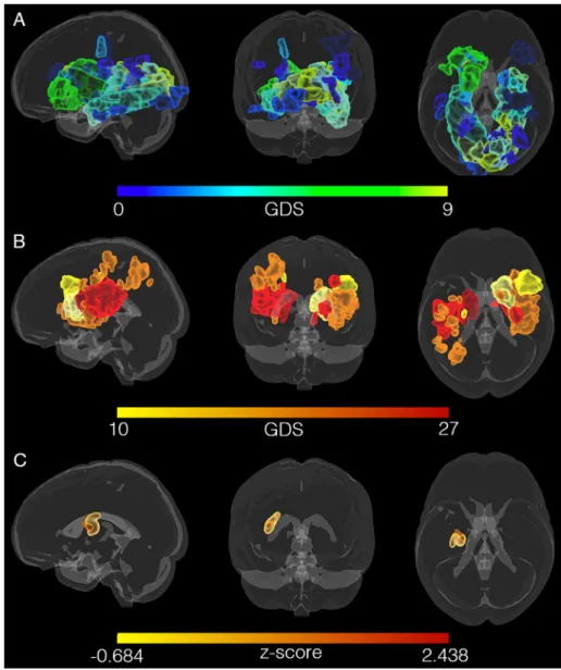 Fig. 2. Lesion locations mapped for all participants in standard (MNI) space does not reveal a pattern of association between GDS scores and lesion location.