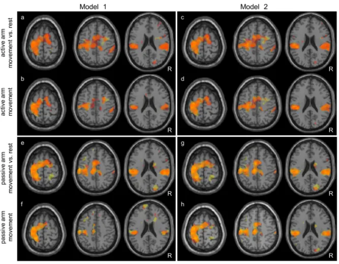 Figure 2.2 Transversal sections showing the overlap of activation in both fMRI sessions for all contrasts  of  interest  and  for  model  1  (a,  b,  e,  f)  and  model  2  (c,  d,  g,  h)  (p  &lt;  0.001  uncorrected  for  multiple  comparisons)