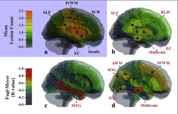 Fig. 6. Diagram of ipsilesional ROIs in the control template space, showing the lesion distribution and the correlation coefﬁcients of logarithmic difference volume and composite Fugl-Meyer (FM) score