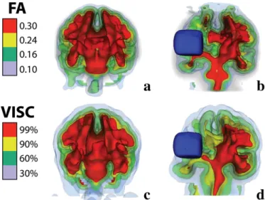 Fig. 9. Using 3D isosurfaces, a visual comparison of FA (top) and VISC (bottom) in a control (left) and a stroke (right)