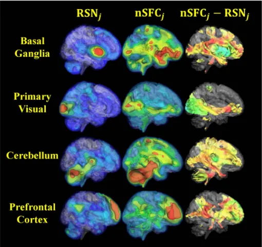 Fig. 6. 3D visualization of structurofunctional resting-state networks in healthy individuals