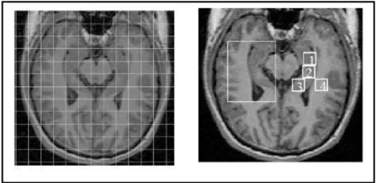Figure  2.3.1:  Axial  T1  weighted  images  of  a  control  patient  showing  the  hippocampal  formations  bilaterally