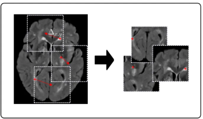 Figure 2: Training patch sampling.