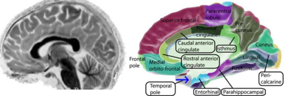 Figure 1.1.1 – Left: Integrated MRI image of my brain displaying high spatial resolution, image produced by 3-T Siemens Magnetom Trio MRI as part of the study by Zeki et al