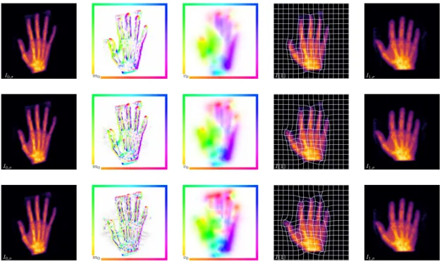 Figure 6.1: Registered hands for regularization parameters β = 2 −1 , β = 2 −3 and β = 2 −5 