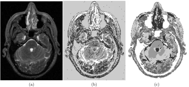 Table 2.3: Image segmentation by the kernel-based fuzzy c-means method with spatial con- con-straints (SKFCM)