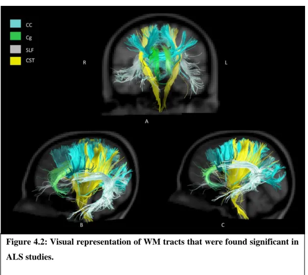 Figure 4.2: Visual representation of WM tracts that were found significant in  ALS studies