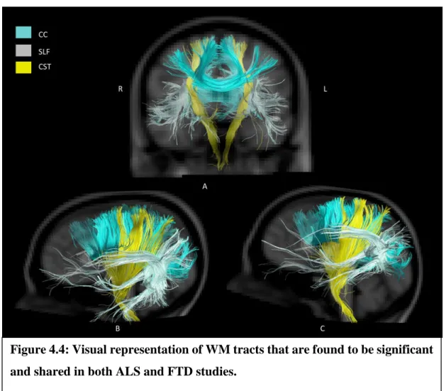 Figure 4.4: Visual representation of WM tracts that are found to be significant  and shared in both ALS and FTD studies
