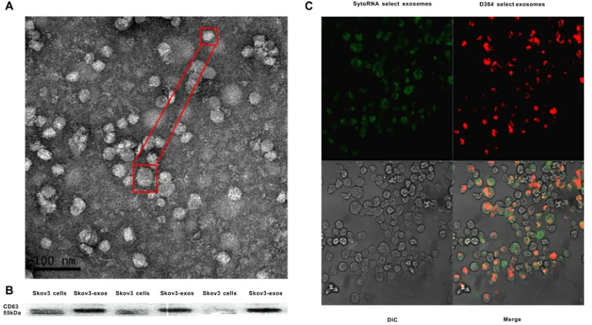 Figure 1: Identification of Skov3 secreted exosomes and internalization of the exosomes into recipient cells