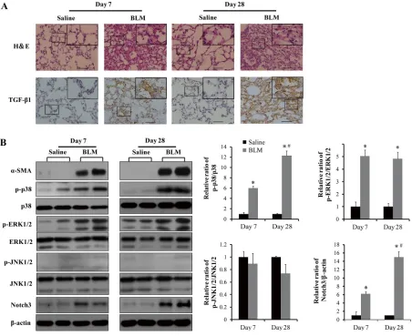 Figure 8: Analyses of phosphorylation of MAPKs, TGF-β1 and Notch3 expression in lungs of (BLM) bleomycin-injured and control mice