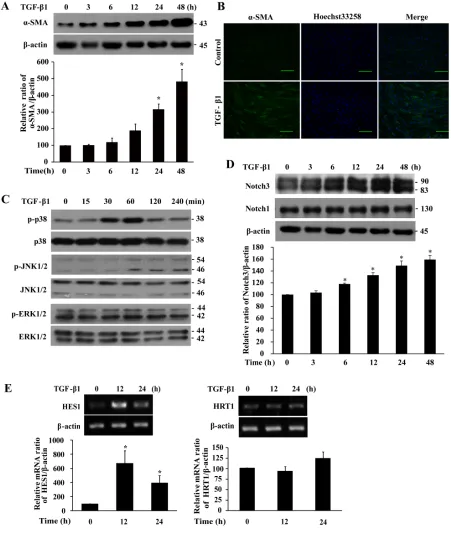 Figure 1: TGF-β1 induces differentiation, p38 and JNK1/2 phosphorylation, and Notch3 expression in IMR-90 fibroblasts.