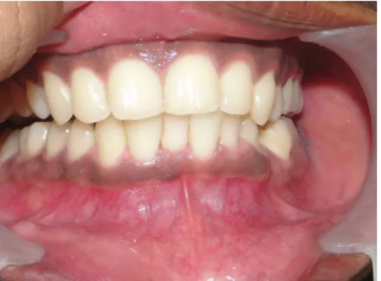 Figure 1: Pre-Operative View 
