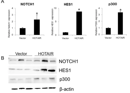 Figure 8: HOTAIRNOTCH1performed in triplicate. Data are mean ± SD. * overexpression promotes the expression Notch pathway genes in xenografts