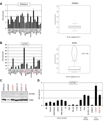 Figure 2: Expression analyses of STAG3L4 and AUTS2. (A) RQ-PCR analysis of STAG3L4 in T-ALL cell lines (left)