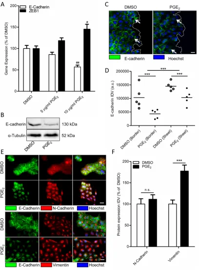 Figure 1: Effect of PGE2 on EMT in A549 cells. A. Gene expression of E-cadherin and ZEB1 following 18 hours stimulation with PGE2 (10 μg/ml)
