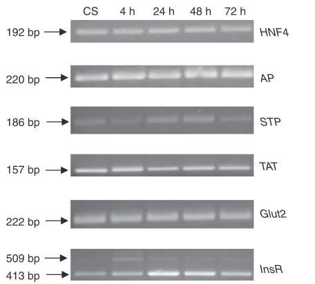 Fig. 2. (A) Western blot analysis of Akt phosphorylation in rainbowtrout liver 2, 4 and 6 h after intraperitoneal administration of insulinand B (CPT1 A and B) and fatty acid synthase (FAS) mRNA levelsbisphosphatase (FBPase), carnitine palmitoyltransferase