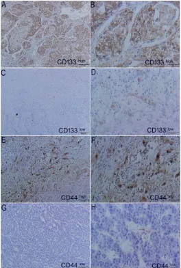 Figure 2: Expression of markers CD133 and CD44 in tumors using HE staining (left panel) and IHC (right panel) from patients