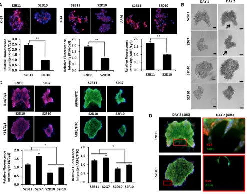 Figure 4: Overexpression of K14/ARF6 in aggressive CD49f+/CD44+/CD24− single-cell derived clones