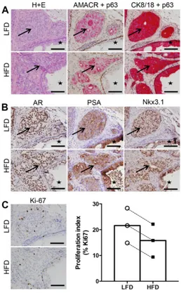 Figure 2: High fat feeding does not promote increased proliferation in patient-derived xenograft tissue