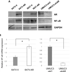 Figure 5: Effects of androgen on NF-κB expression in bladder cancer cells. Western blotting of AR, NF-κB, and p-NF-κB in 647V-AR, 5637-AR, and UMUC3 cells