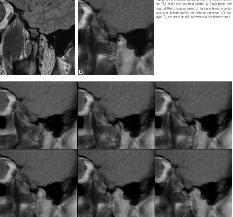 Fig 1. A, Static sagittal oblique proton-attenuation image of