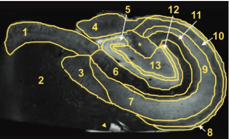 Fig 2. Manually segmented regions of interest on a non-diffusion-weighted image of ahuman hippocampus
