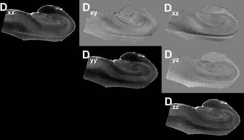 Fig 4. Images of the components of the diffusion tensor visualized on a section from one of the human hippocampus autopsy specimens