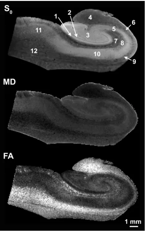 Fig 5. Sixty-micrometer in-plane resolution images of no diffusion-weighting (SFA in the human hippocampus