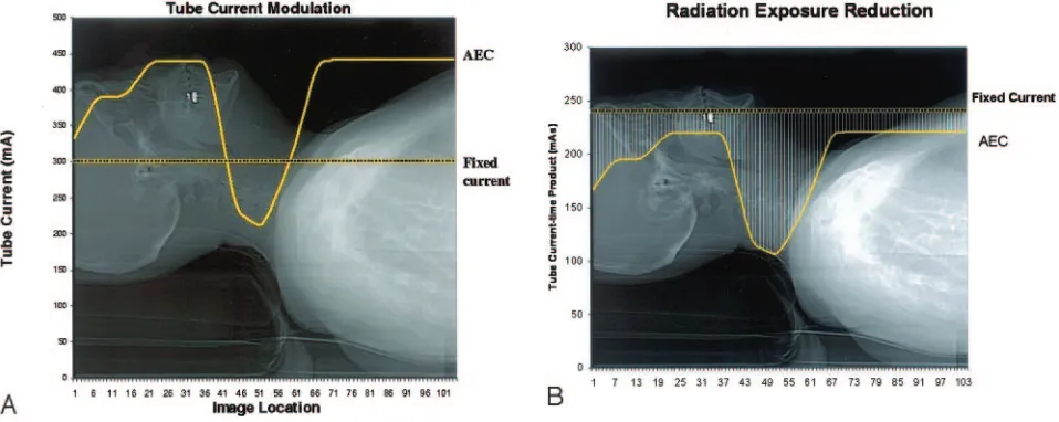 Fig 1. Graphs illustrate schematic representations of the modulation of tube current (Radiation dose (mAcontrol (AEC) technique (A) and, hence, tube current-time product (mA � s) (B) with body region along z-axis in automatic exposurecontinuous lines in A 