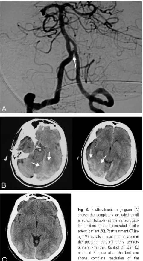 Fig 3. Posttreatment angiogram (A)