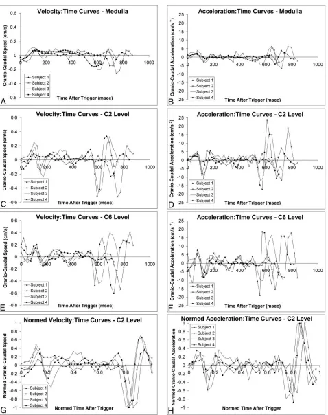 Fig 1. Cranio-caudal movement of the medulla (levels show a period of relative quiescence between 200 and 550 msec after peripheral trigger