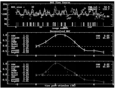 Fig 1. Time course analysis of the response in V1 to the M and P stimuli for a single subject